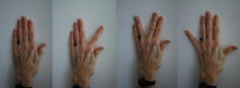 Лечебная физкультура: упражнения для пальцев рук, для кистей