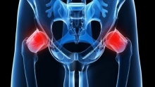 Тазобедренный сустав, рентген: особенности проведения, преимущества и недостатки