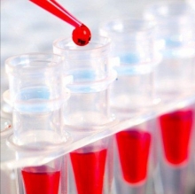 Как готовиться к сдаче биохимического анализа крови? Как проходит подготовка к сдаче крови на биохимический анализ пациента?