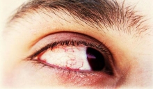 Вспышки в глазах: причины, симптомы