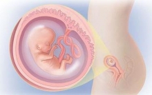 Аборт на 10 неделе беременности: где сделать, последствия
