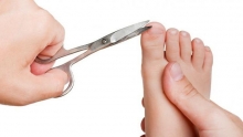 Скоба Фрезера – безболезненное лечение вросшего ногтя на ноге