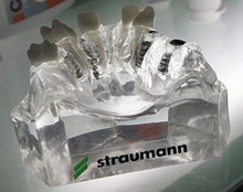 Импланты "Штрауман": особенности, виды и отзывы