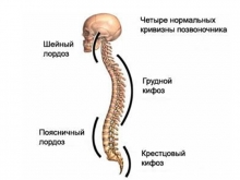 Кифоз - симптомы искривления позвоночника, виды кифоза, особенности форм, диагностика и лечение кифоза