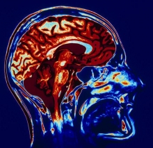 МРТ головного мозга: как проходит процедура? Как подготовиться к МРТ головного мозга?