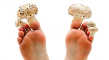Какой врач лечит грибок ногтей на ногах - миколог или дерматолог?