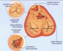 Порок сердца