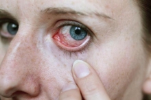 Глисты в глазах: причины и диагностика