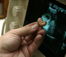 Первый аборт у нерожавшей женщины