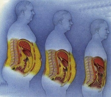 Большой сальник: анатомия, патология, лечение
