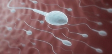 Повышенная вязкость спермы: причины и лечение. Нормальная вязкость спермы