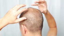 Фолликулит волосистой части головы: причины, симптомы, лечение