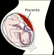 Ручное отделение плаценты: способы и техника выполнения