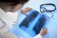 Кашель при туберкулезе: особенности и симптомы
