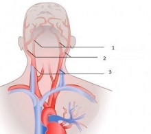Анатомия. Общая сонная артерия