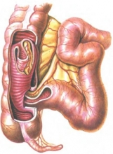 Инвагинация кишечника у детей
