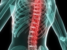 Болезнь Бехтерева - симптомы хронического воспаления суставов, его причины, механизм развития и лечение