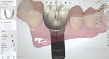 Новейшие технологии в стоматологии: обзор методов, особенности и отзывы