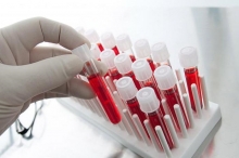 Как обозначаются лейкоциты в анализе крови и каковы их нормы?