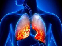 Эозинофильная пневмония: описание, симптомы, причины и особенности лечения