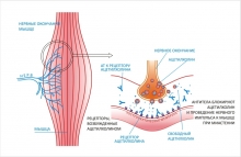 Миастения - симптомы нервно-мышечного заболевания, особенности течения и лечения миастении