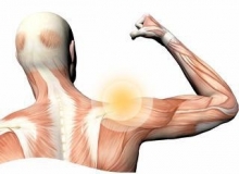 Плексопатія плечевого сплетения: симптомы и лечение