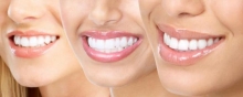 Профилактическая стоматология для предупреждения болезней зубов и десен