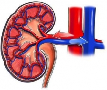 Стеноз почечной артерии: возможные причины, симптомы и особенности лечения