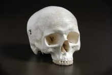 Возрастные особенности черепа. Череп младенца. Швы черепа: анатомия