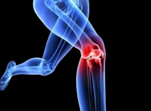 Лечебная физкультура при артрозе коленного сустава: упражнения, правила их выполнения