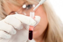 Что означает анализ крови АФП? Альфа-фетопротеин: расшифровка