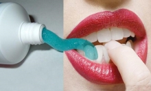 Как проводится отбеливание зубов: методы. Отбеливание зубов: наиболее эффективные и безопасные способы. Рекомендации стоматологов