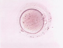 Овогенез — это процесс формирования яйцеклеток. Сперматогенез и овогенез