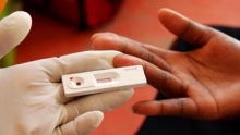 Анализ на ВИЧ: сроки готовности, где и когда сдавать