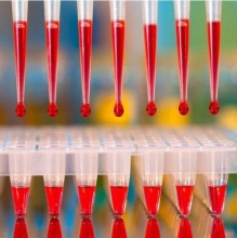 Гемоглобин в анализе крови: обозначения. Расшифровка анализа крови