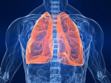 Левосторонняя нижнедолева пневмония: симптомы и лечение