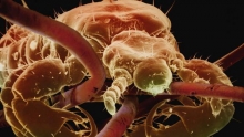 Эктопаразиты - это что такое? Как избавиться от паразитов на поверхности тела человека и животных?
