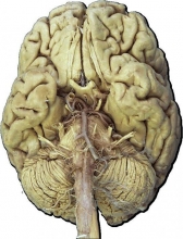 Черепные нервы 12 пар: анатомия, таблица, функции