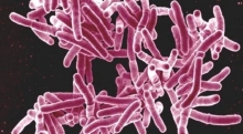 Туберкулез кишечника: причины, симптомы, диагностика и лечение