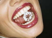 Скайсы на зубы: виды и установка