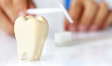 Фрактура стенки зуба вследствие кариеса – обломка стенки зуба вследствие кариеса - лечение, отламывание, кариес, лечение, фрактури стенок зуба