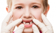 Гингивит у детей – “зеркало” гигиены полости рта - детская стоматология, гигиена рта, гингивит