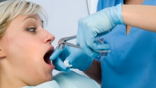 Кровотечение из лунки удаленного зуба - лечение, удаление зуба, кровотечение