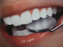Лазерное отбеливание зубов - гигиена и эстетика, гель, лазерное отбеливание зубов, процедура