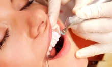Профессиональная чистка зубов: как его делают и какие могут быть противопоказания? - гигиена и эстетика, противопоказания, ультразвук, чистка зубов