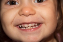 Серебрение молочных зубов: польза, вред, альтернативы - интересное, дети, недостатки, преимущества, серебрение зубов, фторирование
