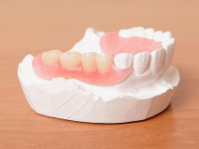 Съемные зубные протезы: плюсы и минусы - протезы и импланты, съемные зубные протезы, недостатки, преимущества