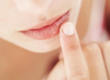 Трещины в уголках губ, лечение трещины губы - лечение, лечения, последствия, трещина губы