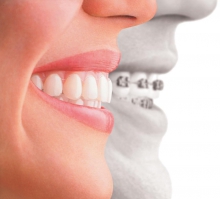 Украшения зубов – уникальная улыбка - гигиена и эстетика, зубы, драгоценности, украшения, скайсы
