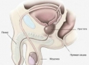 Простатит